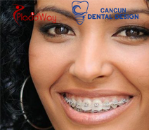 Slider image (4) Cancun Dental Design